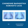 Ультра увлажняющий крем для гладкости и сияния Benetus Acniome Derma Moisture Cream — изображение 7